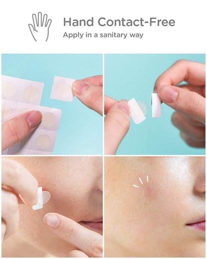 Derma Angel Acne Patches 6x Day & 12x Night Mix Treat Acne Pimples - Ultra Thin-